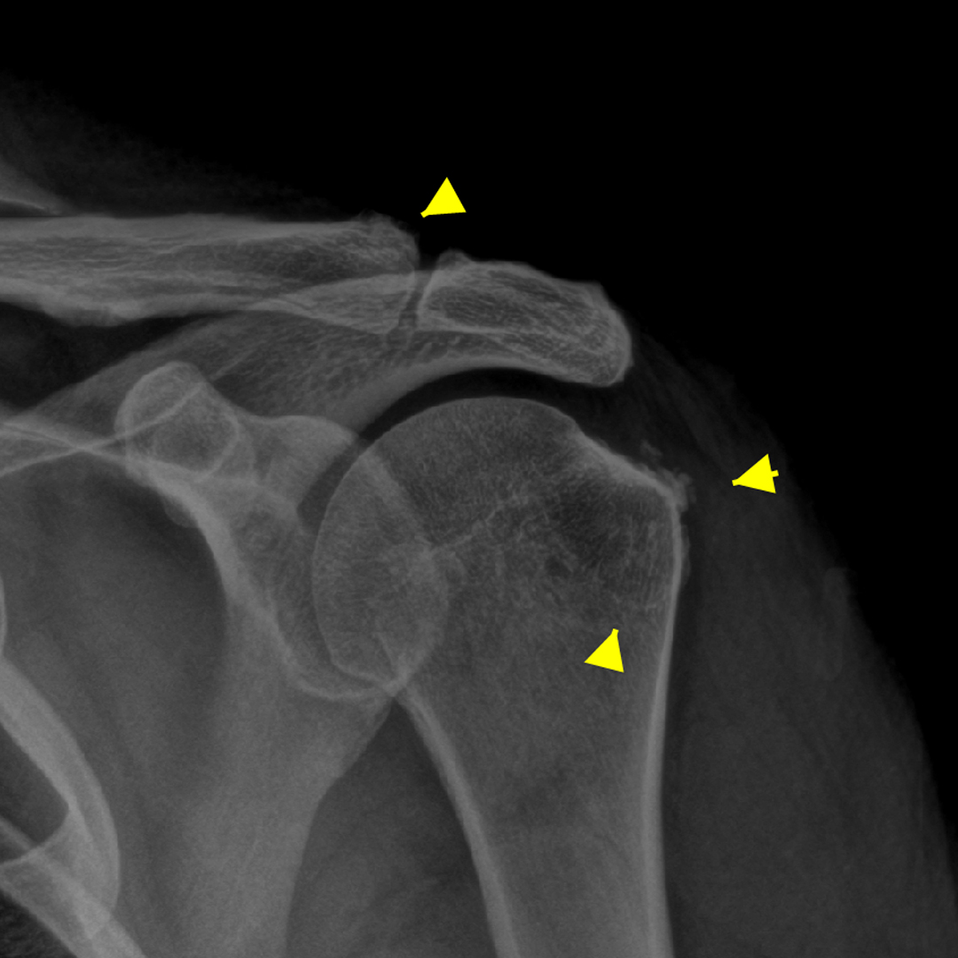 Xray 1