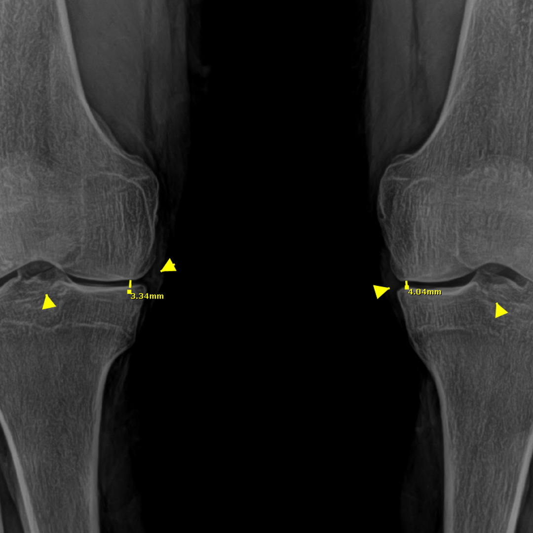 Xray 3