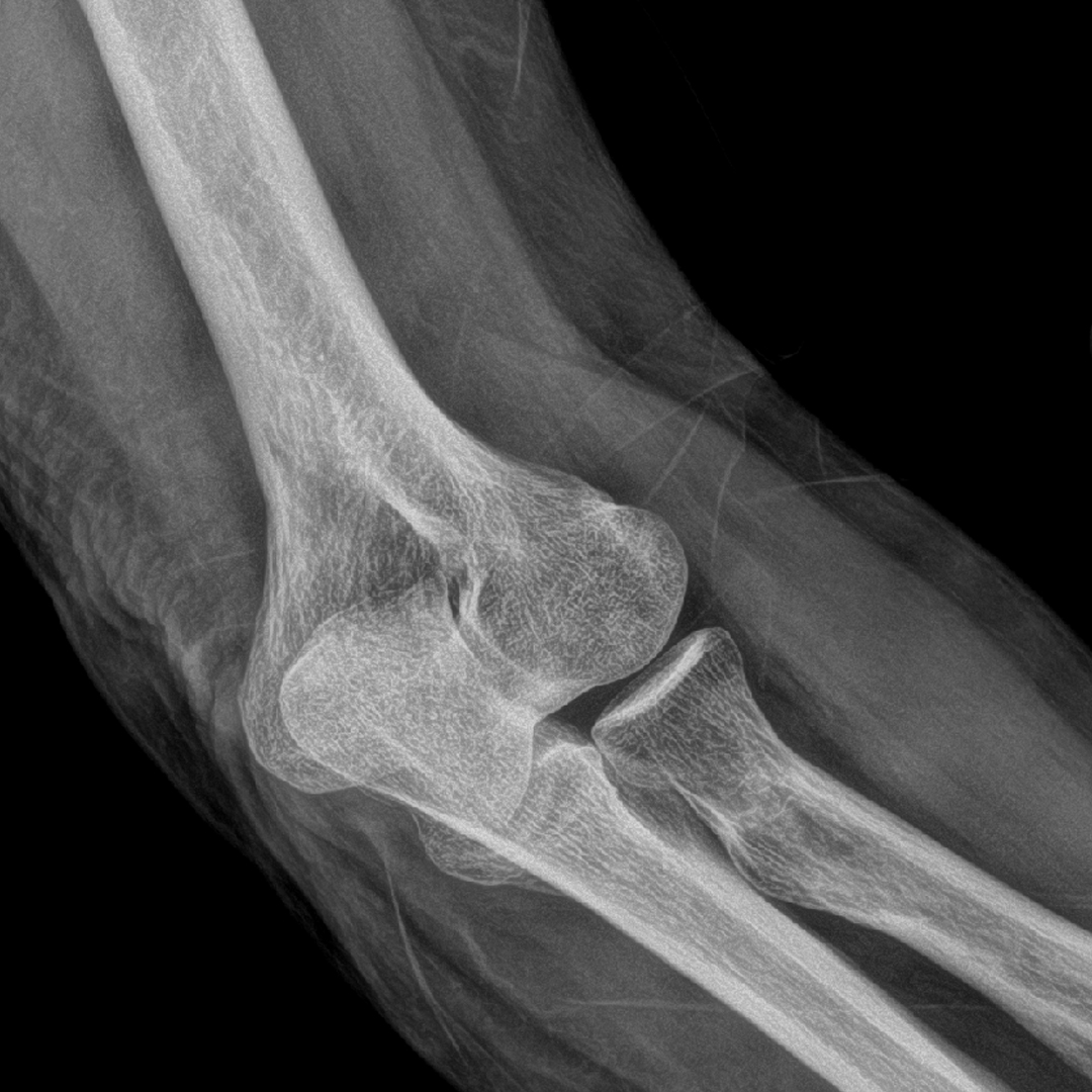 Xray 4