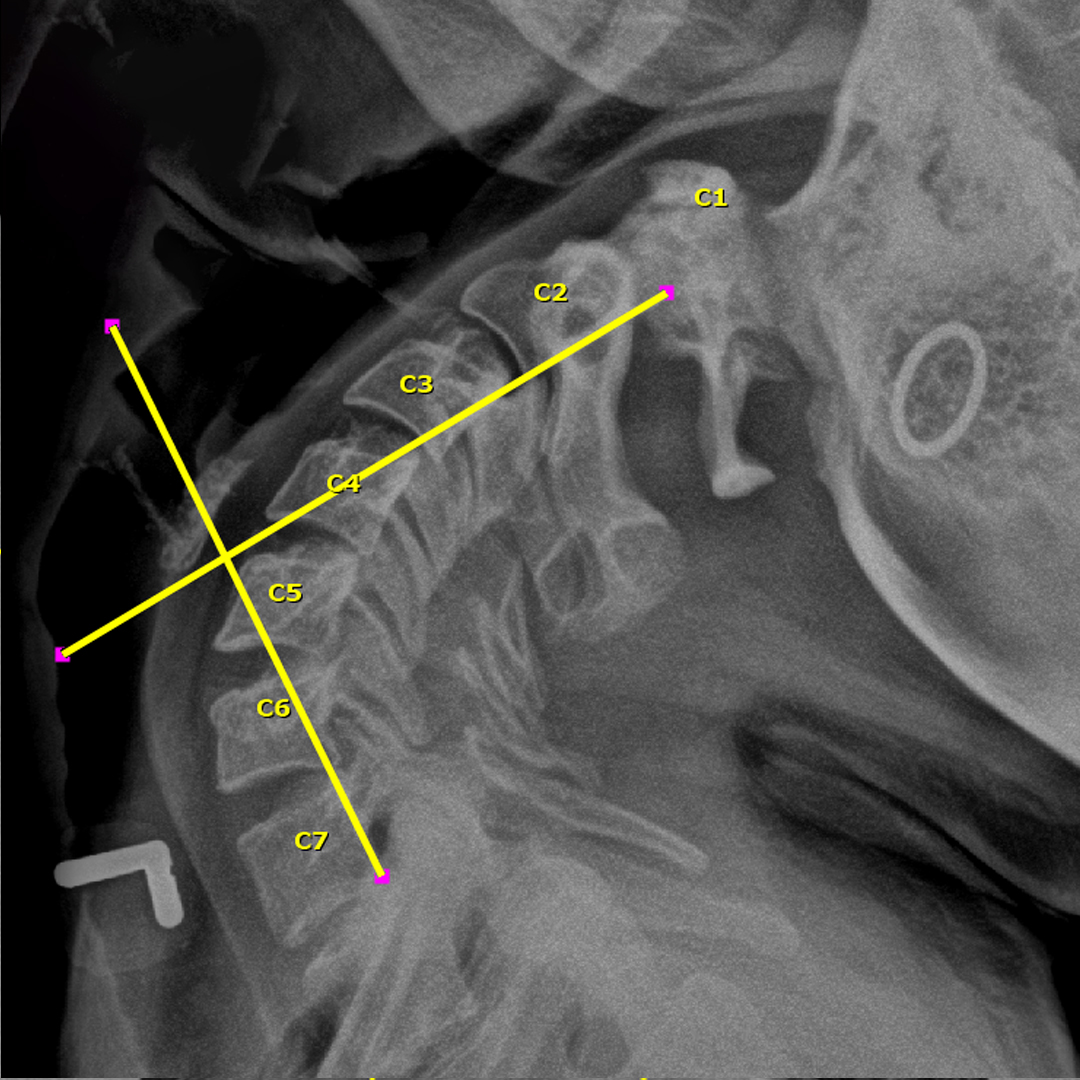 Xray 7