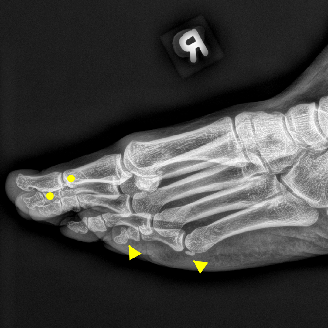Xray 9